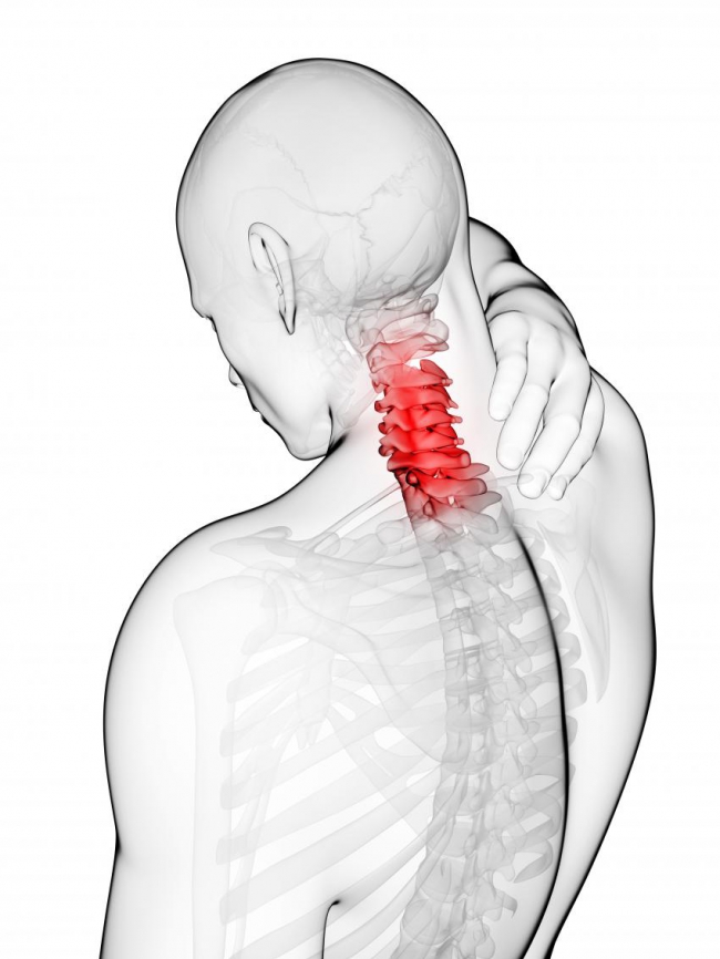 Recuperare Spondiloza | Clinica de scolioza Müller