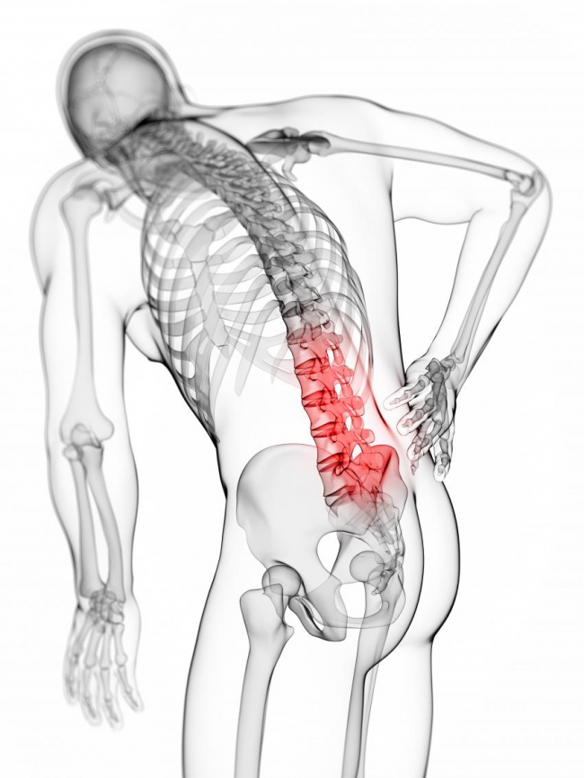 Recuperare Hernie de Disc | Clinica de scolioza Müller